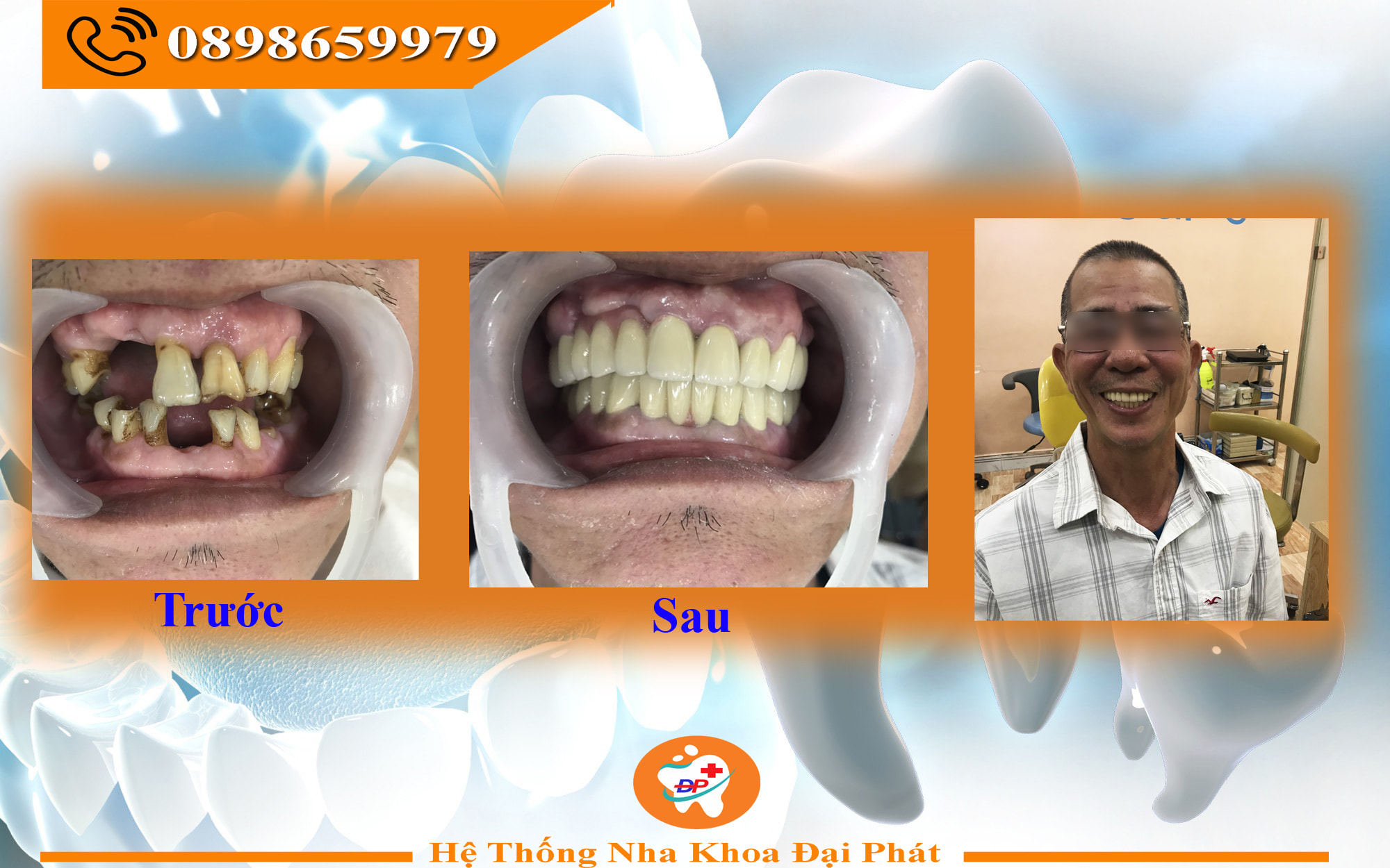 BẠN BỎ LỠ CƠ HỘI TRONG CUỘC SỐNG VÌ KHUYẾT ĐIỂM RĂNG NIỆNG ?