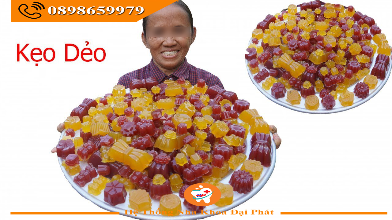 Kẻo dẻo và tác hại với răng miệng
