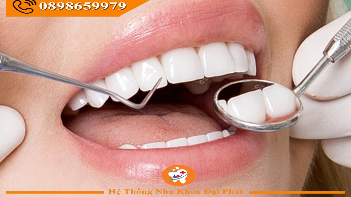 Hướng dẫn chăm sóc sức khỏe răng miệng đúng cách