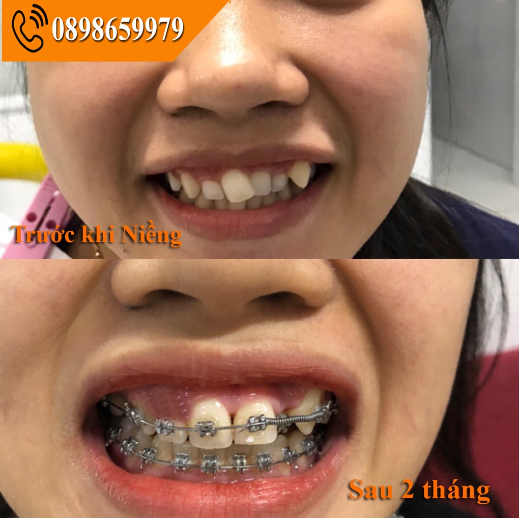Khách hàng ở Bình Dương đã chọn Nha Khoa Đại Phát