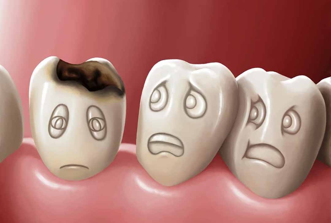 10 bệnh răng miệng phổ biến nhất