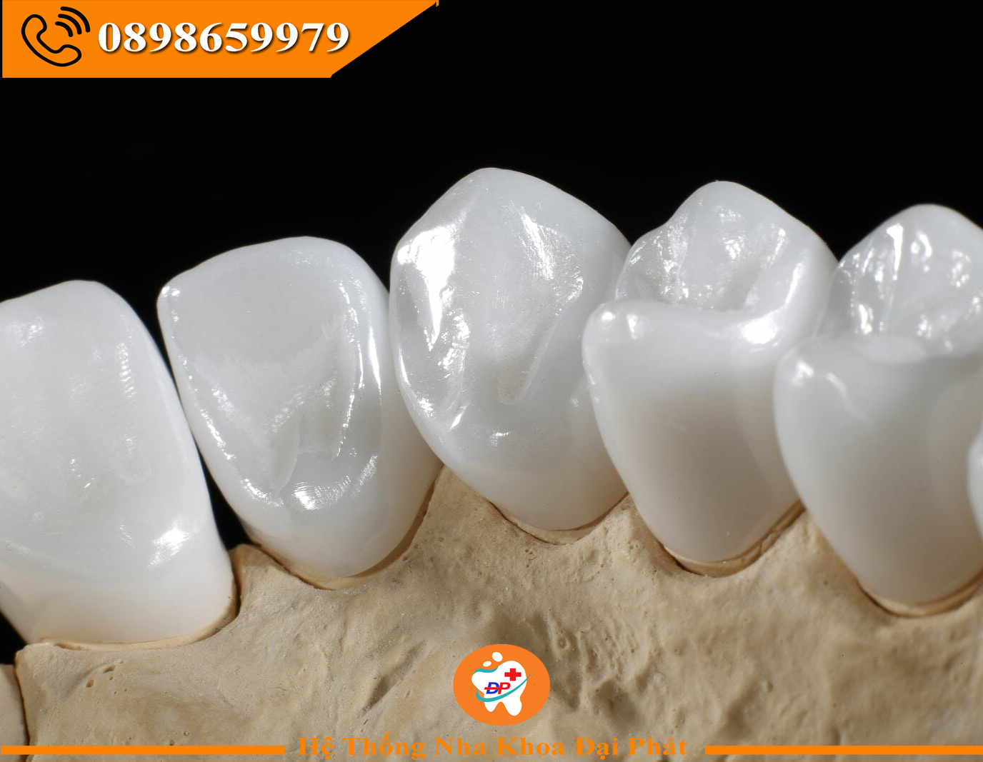 Răng Sứ Có Làm Giống Màu Răng Thật Được Không ?
