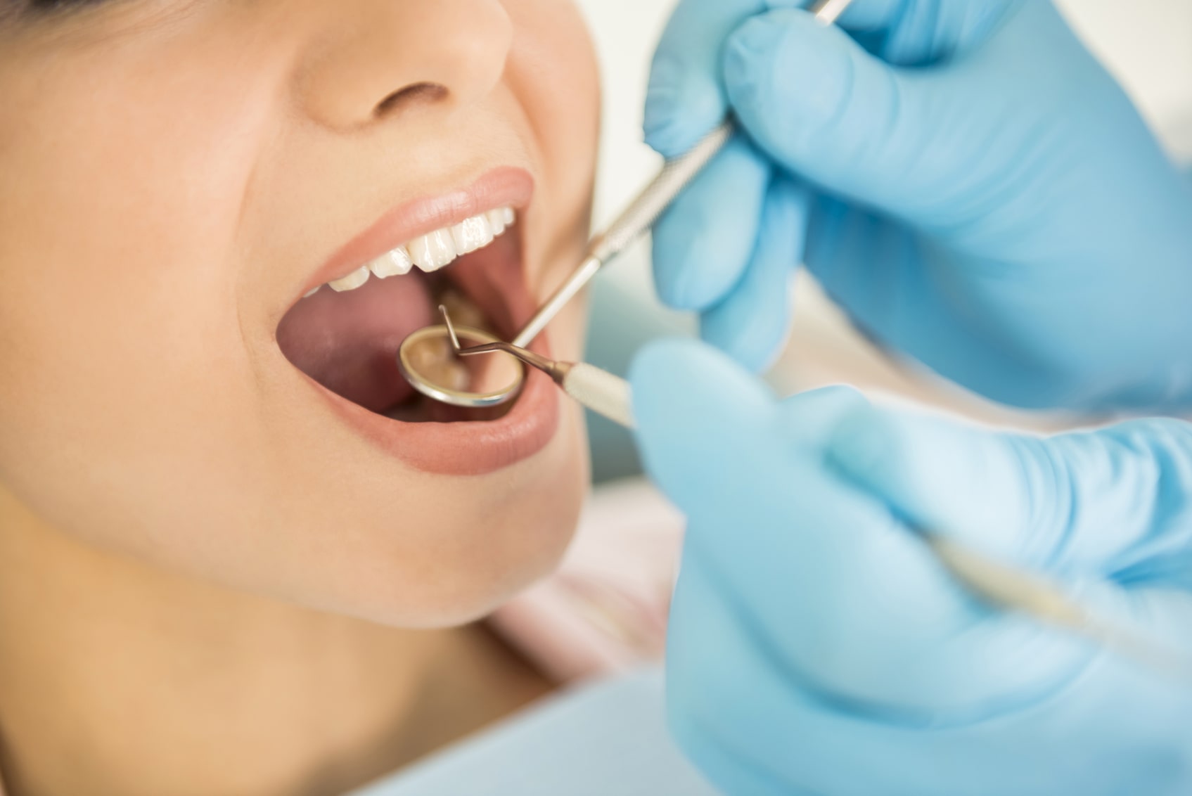 NÊN KHÁM RĂNG ĐỊNH KỲ BAO LÂU MỘT LẦN ?