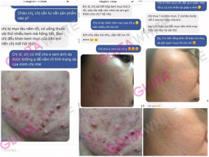 FEEDBACK TRỊ MỤN