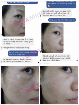 FEEDBACK TRỊ NÁM