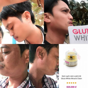 FEEDBACK TRỊ NÁM TỪ  NGÀY 18/1/2018 - 28/1/2018