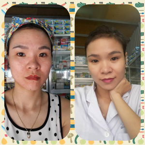 TỔNG HỢP FEEDBACK KHÁCH HÀNG NĂM 2017