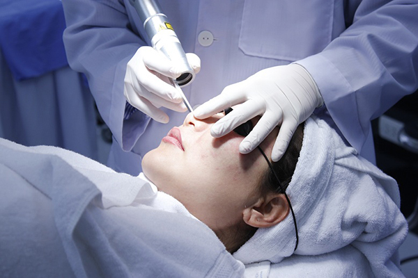 Hậu quả của việc trị nám bằng Laser