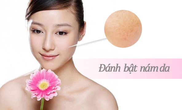 Lạm dụng mỹ phẩm trị nám - con dao hai lưỡi với da mặt