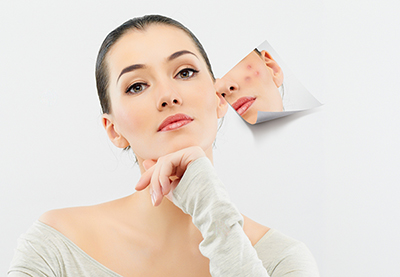 Những sai lầm nặn mụn gây chết người mà ít ai biết ?