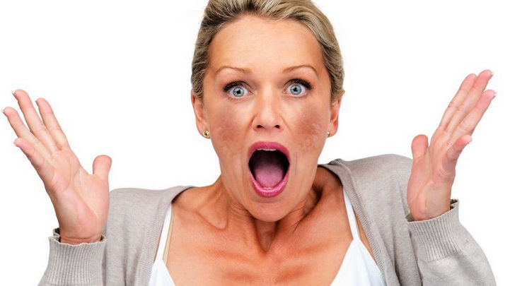 Hé lộ những sai lầm khi điều trị nám da không ngờ tới