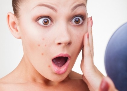 Tìm hiểu ngay những nguyên nhân bị mụn ở các vùng cấm để tìm cách điều trị