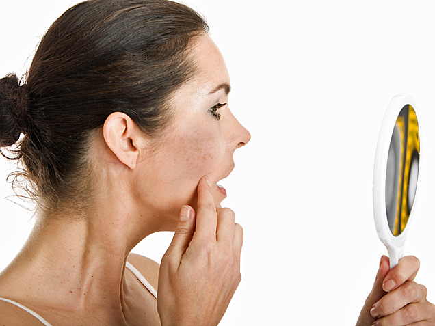 Da trở nên sạm đen sau khi điều trị nám