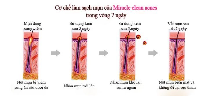 Hiểu nhầm về cơ chế trị mịn, khiến mụn lên càng ngày càng nhiều