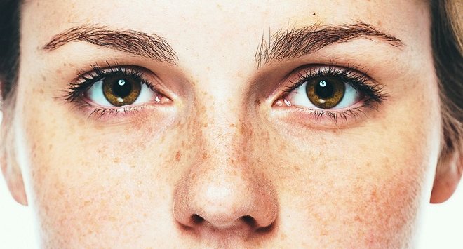Thoát khỏi nám da một lần và mãi mãi bằng 5 bước đơn giản